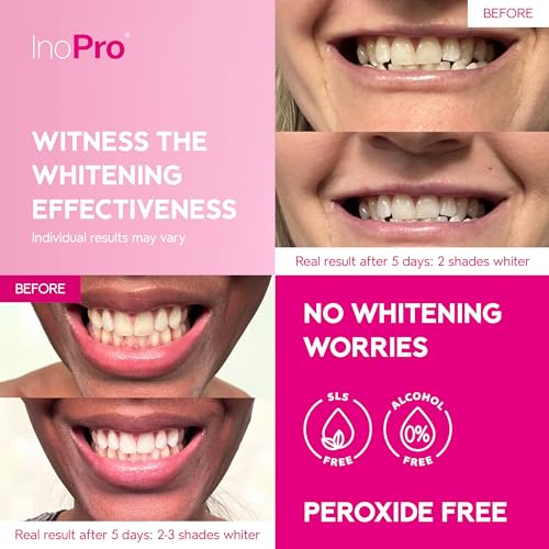 InoPro Teeth Whitening Strips 14 Treatments Kit - Enamel Safe Teeth Whitener, Peroxide-Free, Green White Strips for Teeth Whitening with Arbutin, Coconut Oil, Deep Stains Removal (28 Strips)