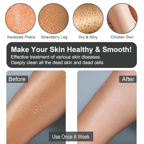 Yiclick 12Pcs Heavy Exfoliating Gloves, Body Scrub Glove For Shower Bath, Body Scrub Exfoliator, Exfoliating Body Scrubber for Bath Shower Exfoliation, Exfoliate Sponge Loofah Washcloth Mitt Men Women