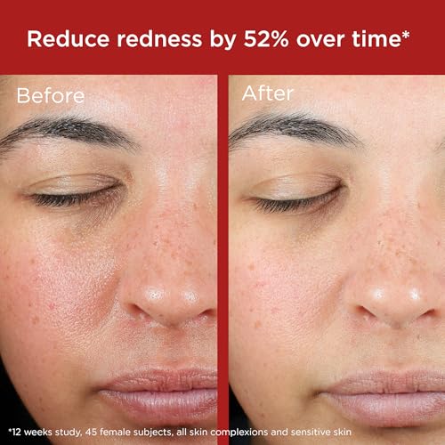 EltaMD UV Skin Recovery Face Sunscreen with Zinc Oxide, All Mineral, Safe for Sensitive Skin SPF 50