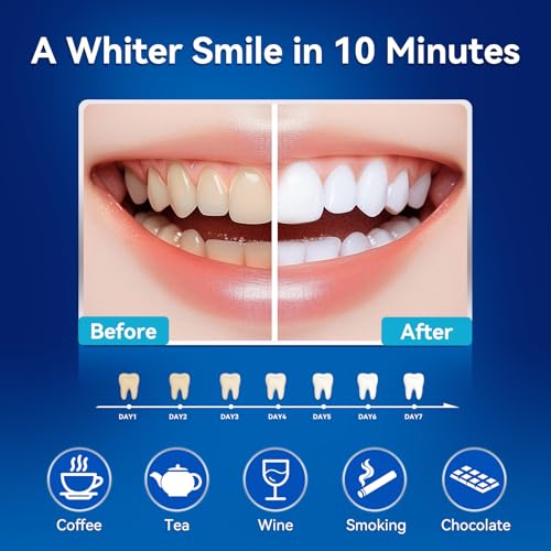 Teeth Whitening Kit, LED Accelerator Light, 3 Carbamide Peroxide Whitening Gel, Dental-Grade Whitening at Home