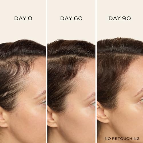 John Frieda ULTRAfiller+ Hair Density Scalp Serum for Fine Hair, Volumizing Hair Serum, Scalp Treatment for Thickening for Women and Men, 2 Oz