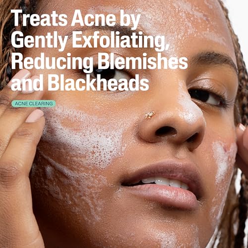 Cetaphil Gentle Clear Pore Clearing Acne Cleanser, Foaming Gel Cleanser for Sensitive, Acne-Prone Skin, 8 Fl Oz Pump Bottle, 2% Salicylic Acid, Gently Exfoliates, Dermatologist Recommended Brand