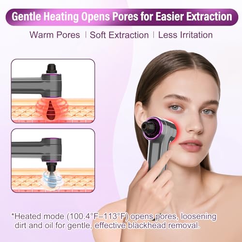 Blackhead Remover Vacuum, Pore Vacuum Blackhead Extractor, Pore Suction Face Suction, Electric 5 Heads Heating, Nose & Face Deep Clean, Pimple Sucker Remover Tools, USB Rechargeable 9 Modes 3 Levels