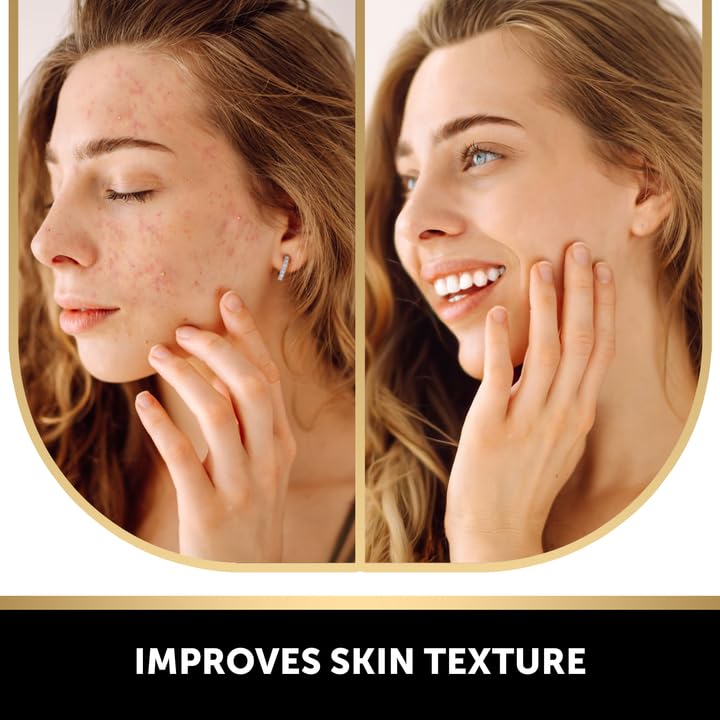 VALITIC Kojic Acid Dark Spot Remover Soap with Turmeric, Vitamin C, Retinol - Original Japanese Complex with Hyaluronic Acid, Vitamin E, Shea Butter, Castile Olive Oil - 2 Pack and African Net Sponge