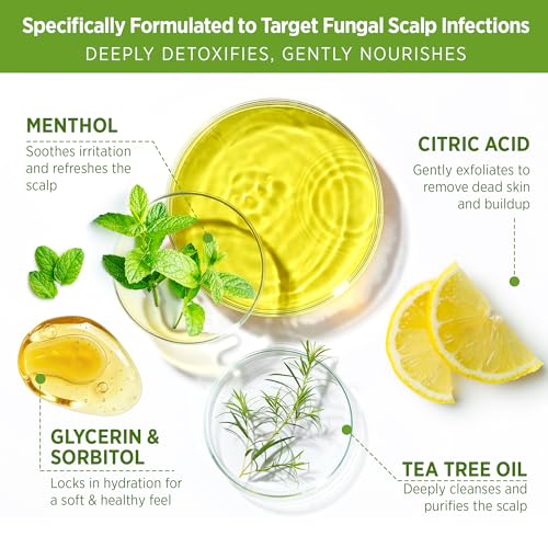 Roycederm Tea Tree Scalp Scrub – Pre-Shampoo Exfoliating Treatment for Dry, Flaky Scalp – Deep Cleansing, Refreshing & Balancing Formula for Healthy-Looking Hair