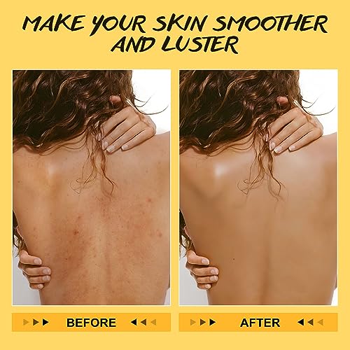 POP MODERN.C Turmeric and Vitamin C Body Scrub Remove Dead Skin Improve Dark Spots Acne Natural Organic Exfoliating Deep Cleansing Exfoliator for Body Butt Bikini Area Body Care with Loofah