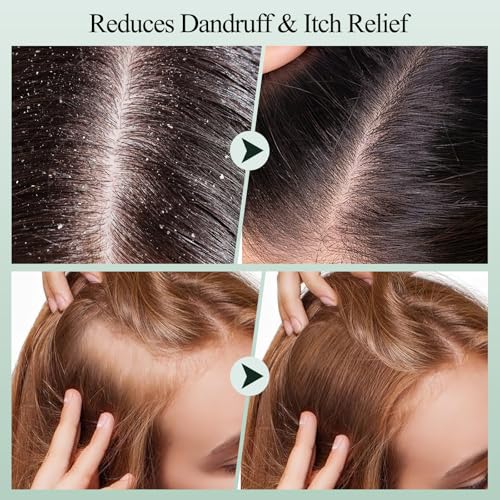 Scalp Scrub, Rosemary Scalp Exfoliator Scrub Shampoo, 2-in-1 Scalp Treatment with Mint Oil, Hair Treatment to Clarify and Remove Build Up with Silicone Scalp Massager, 10.6oz/300g