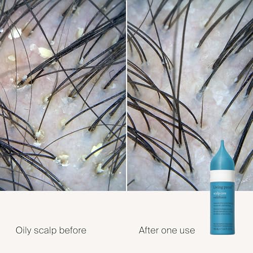 Living Proof Scalp Care Exfoliator