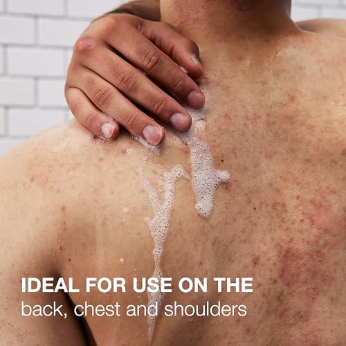 Neutrogena Salicylic Acid & PHA Stubborn Acne Body Wash, Exfoliating Cleanser Acne Treatment for Chest & Shoulder, Gently Clears, Exfoliates & Helps Prevent Breakouts, Fragrance Free, 8.5 Fl Oz
