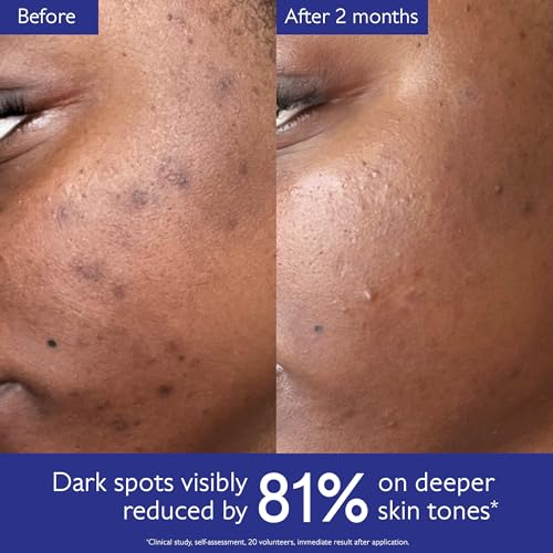 Caudalie Vinoperfect Brightening Dark Spot Serum Vitamin C Alternative - 62x More Effective than Vitamin C with Viniferine for a Visibly Brighter Even Complexion