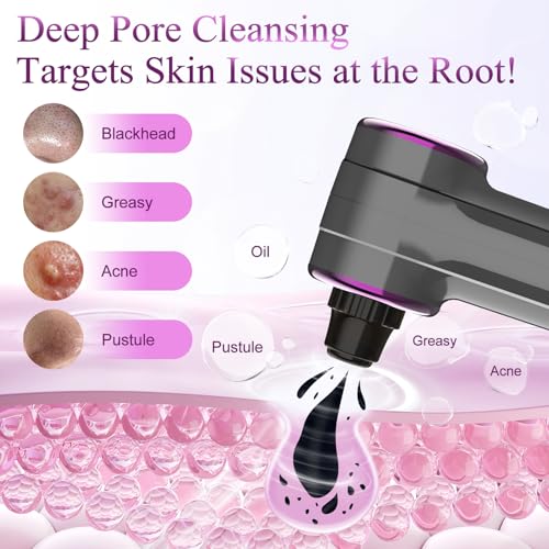 Blackhead Remover Vacuum, Pore Vacuum Blackhead Extractor, Pore Suction Face Suction, Electric 5 Heads Heating, Nose & Face Deep Clean, Pimple Sucker Remover Tools, USB Rechargeable 9 Modes 3 Levels