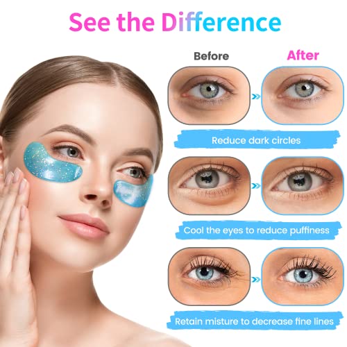 Onespring Under Eye Patches (24 Pairs) - Eye Masks for Wrinkles, Puffy Eyes, Dark Circles, Eye Bags, Valentine's Day Gift, Gifts for Teenage Girls, Under Eye Mask for Refreshing, Revitalizing