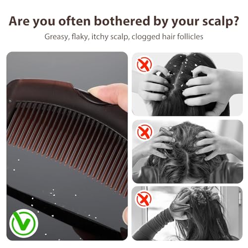 Dandruff Comb, Hollow Tooth Button Comb, Detoxing Comb Energy Massage Comb, Scalp Psoriasis Comb Dandruff Removal Comb, Lice Comb Multifunctional Hairbrush For Women Men Kids