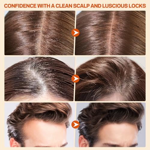 Scalp Scrub, Pumpkin Seed Oil Scalp Exfoliator With Biotin & Rosemary, Sulfate Free Scalp Detox for Itchy Scalp & Dandruff & Buildup Removal & Hair Growth, Hair Scrub with Scrubber