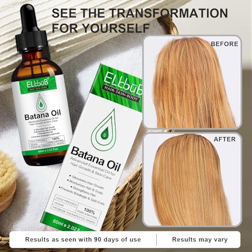 Dr. Sebi Raw Batana Oil - Hair Growth Oil for Men & Women, Sourced from Honduras, Pure & Unrefined, Nourishing Scalp & Hair, Promotes Hair Thickness, Prevents Hair Loss