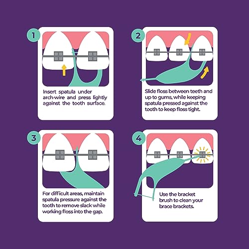 Platypus Orthodontic Flossers for Braces, 30 Count (Pack of 1), Ortho Picks for Adults & Kids, Fits Under Arch Wire, Non-Damaging, Encourage Flossing Habits