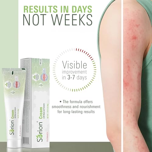 Sorion Cream - Herbal Moisturizer for Dry Skin, Itchy and Flaky Skin with Coconut Oil, Neem, Turmeric and Pala Indigo Skincare Body Cream