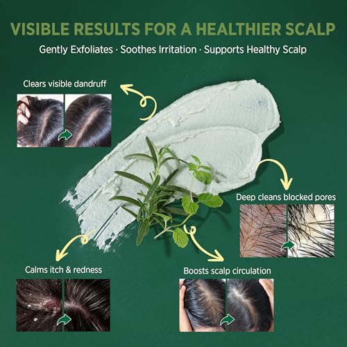 RoyceDerm Rosemary Mint Scalp Scrub Clarifying Scalp Exfoliator Refreshing Clean Scalp, Cooling Micro-Exfoliation with Botanical Extracts, For All Scalp Types (Rosemary Mint Scalp Scrub)