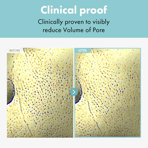 TOSOWOONG Pore Refiner Cream, Pore Minimizer with AHA - Glycolic Acid and Lactic Acid, Oil Control Face Moisturizer for Oily Skin, Texture Smoothing for Fine Lines, Korean Skincare, 50g / 1.76 oz.