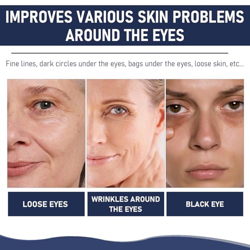 Rapid Reduction Eye Serum, Advanced Formula Instant Eye Serum, Anti Aging Serum Visibly Reduces Under-eye Bags, Nourishing Eye Serum, Suitable For All Skin Type (2Pcs)