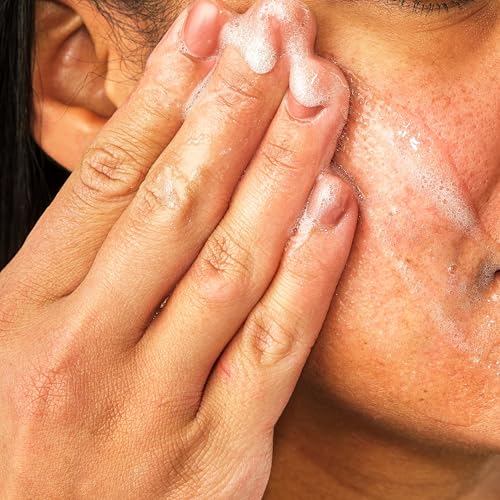 Aveeno Calm + Restore Redness Relief Foaming Cleanser, Daily Facial Cleanser With Calming Feverfew to Help Reduce the Appearance of Redness, Hypoallergenic & Fragrance-Free, 6 fl. oz