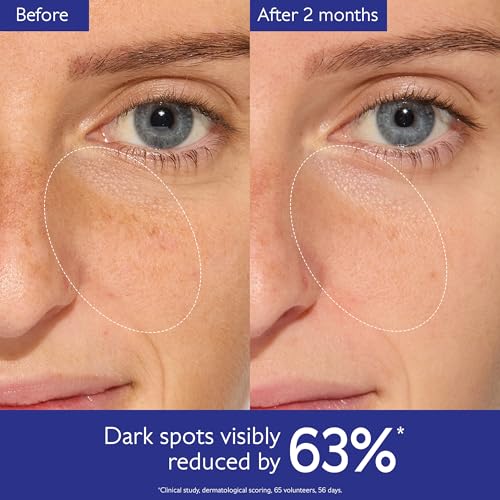 Caudalie Vinoperfect Brightening Dark Spot Serum Vitamin C Alternative - 62x More Effective than Vitamin C with Viniferine for a Visibly Brighter Even Complexion