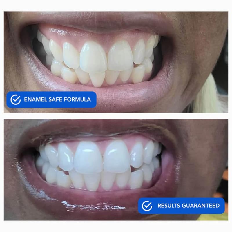 SNOW Diamond Dissolving Teeth Whitening Strips - Gentle & Enamel Safe White Strips for Teeth Whitening, at-Home Dental Hygiene & Tooth Care with Hydroxyapatite - 42 Ct