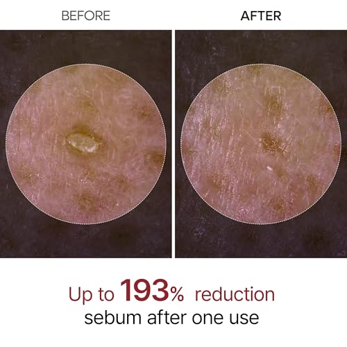 Dr.Melaxin Peel Shot Glow Rice Peeling Ampoule 80ml Daily Soft Exfoliating Face and Body Scrub Dead Skin Cells Blackhead Remover for All Skin Types korean skin care