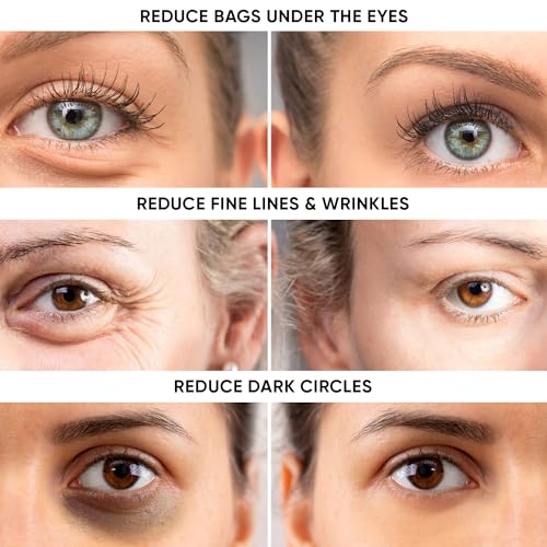 Instant Eye Tightener Cream - Reduces Under Eye Puffiness, Bags, Dark Circles. Lift Technology to Tighten & Firm Sagging Skin Around Eyes. Smooths Away Crow’s Feet, Fine Lines & Wrinkles.