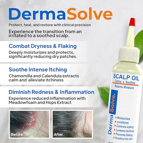 Dermasolve 4 oz Psoriasis, Seborrheic Dermatitis, & Dandruff Scalp Oil - Dermatologist Approved - Flaky Scalp Relief, Clinically Tested, Long-Lasting Itch-Free, High-Performance Formula