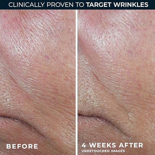 RoC Derm Correxion Retinol Firming Serum Stick with Antioxidants to Visibly Tighten and Firm Wrinkles and Laugh Lines 1.0 oz plus Retinol Eye Cream Packette