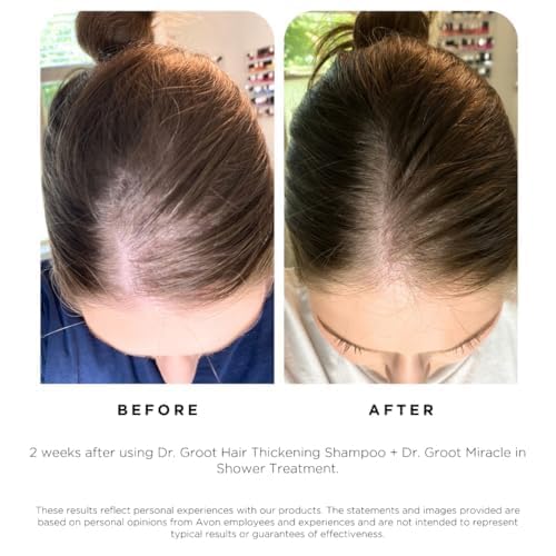 Dr. Groot Scalp Revitalizing Solution Scalp Happiness Set – LIMITED EDITION HOLIDAY SET