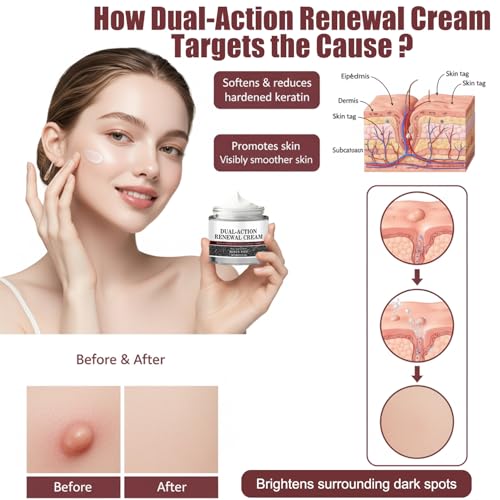 Dual-Action Renewal Cream, Professional Skin Treatment, Black and White Rice Soothing Repair Cream, Natural Body Serum Suitable for All Skin Types