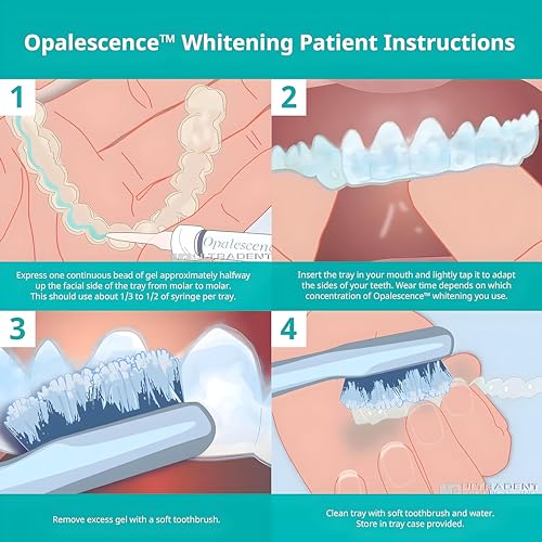 Opalescence 15% Gel Syringes Teeth Whitening Refill Kit - Low Sensivity (4 Syringes) - Cool Mint - Carbamide Peroxide - Made in The USA by Ultradent Tooth Whitening 5195-2
