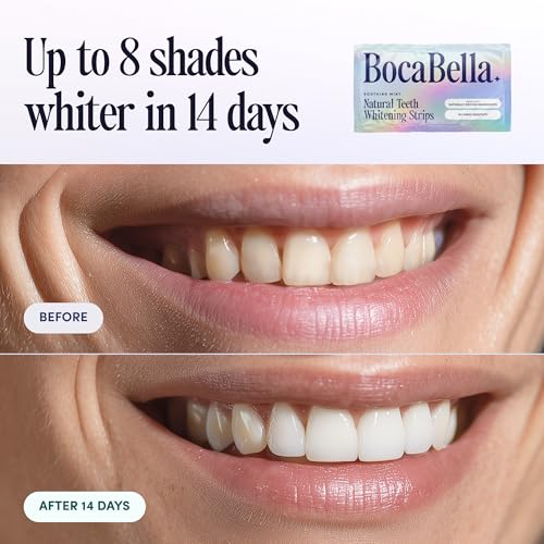 Natural Teeth Whitening Strips – Peroxide-Free, Enamel-Safe & Sensitivity-Free | 7 Treatments | Papaya & Pineapple Enzymes + Coconut Oil | Gentle Daily Stain Removal for a Brighter, Whiter Smile