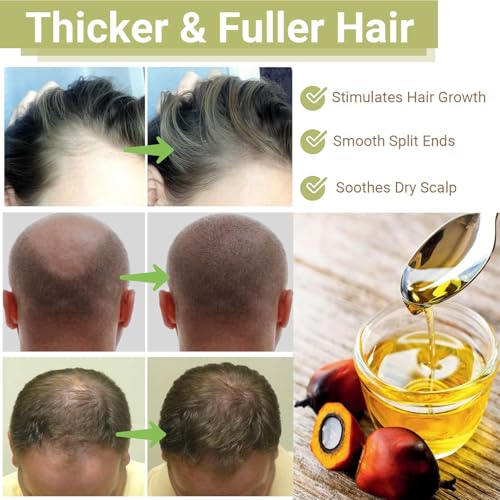 RAW Batana Oil for Hair Growth, Dr Sebi Organic Unrefined Batana Oil from Honduran, 100% Pure & Natural Hair Growth for Thicker & Stronger Hair - 2 FL OZ - 60Ml - 1Pack