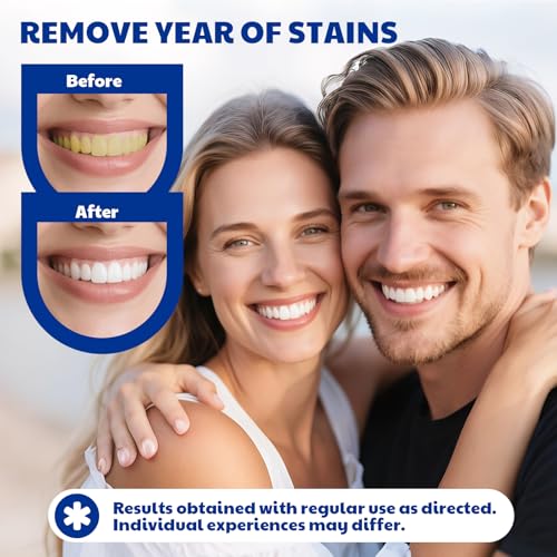 Teeth Whitening Pen - Effective Stain Removal Teeth Whitening Gel Kit, Pro No Sensitivity Teeth Whitener for Bright White, Travel-Friendly, Mint (0.11 Fl Oz (Pack of 4))