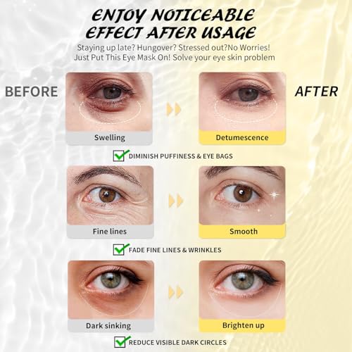 Maskiss Under Eye Patches(25 Pairs), 24K Gold, Caffeine, Hyaluronic Acid, Aloe Vera Eye Masks for Dark Circles Puffy Eyes Undereye Bags, Eye Skin Care Gift Set for Bachelorette Party Favors