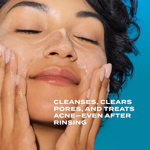Murad Acne Control Clarifying Cleanser – Salicylic Acid & Green Tea Formula for Acne, Deep Pore Cleansing, Oil Control & Breakout Prevention for Clear, Balanced, Healthy-Looking Skin (5 Fl Oz)