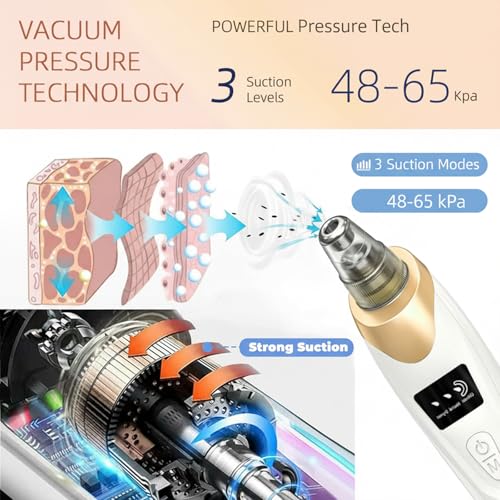 2026 Blackhead Remover with 5 Suction Heads & 4 Gold Extractor Needles, Electric Blackhead Vacuum Pore Vacuum for Deep Facial Cleaning, USB Rechargeable for Women & Men-Khaki