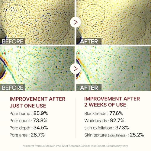 Dr.Melaxin Peel Shot Glow Black Rice Peeling Ampoule 80ml, Dead Skin Gentle Exfoliating Ampoule with Rice Water Extract, AHA BHA, Niacinamide, Daily Skin Texture Care, All Skin Types, Korean Skincare