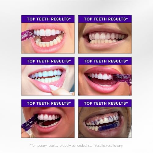 Hismile V34 Whitening Strips, Teeth Whitening Strips, Purple Tooth Whitening, Purple V34 Whitening Strips, Tooth Stain Treatment, Combining Whitening and Colour Correction
