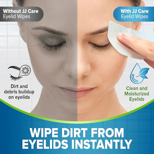 JJ CARE Eyelid Cleaning Wipes 160 PCs, Individually Wrapped Eye Lid Scrubbing Wipes, Moisturizing Eye Wipes for Irritated, Itchy, and Dry Eyes, Hypoallergenic Eye Scrub Cleaning Pads