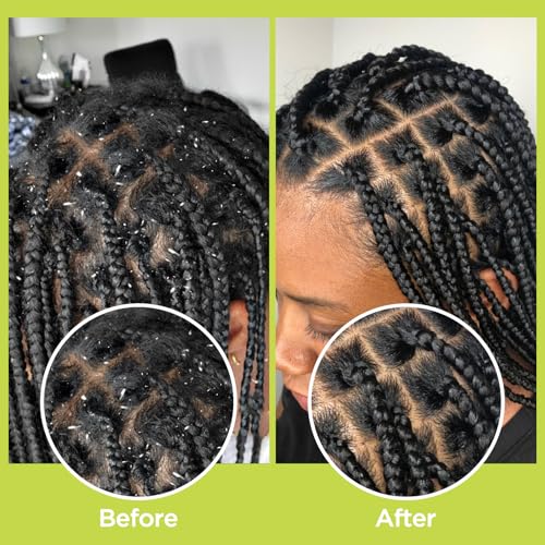 Rosemary & Apple Scalp Exfoliating Tonic - Scalp Detox Serum Deep Cleansing & Clarifying Treatment for Buildup, Dry Flaky Scalps - Soft Silicone Hair Scalps Massager Shampoo Brush for All Hair Types