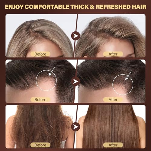 Scalp Scrub, 2-in-1 Scalp Exfoliator Clarifying Shampoo for Dandruff, Dry & Itchy Scalp Care, Batana Oil & Rosemary Scrub Scalp Treatment with Scalp Massager Promotes Hair Growth, 10.93 oz