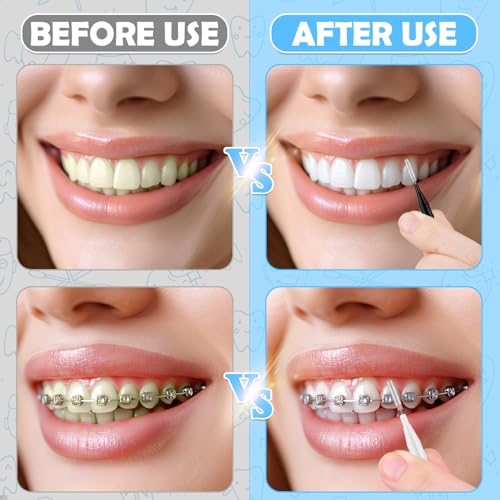 120Pcs Interdental Brushes, 360° Bendable Soft Bristles Braces Flossers Dental Brushes Between Teeth Gum Interdental Brushes for Gum Braces Oral Teeth Cleaning Tool (Black, White)