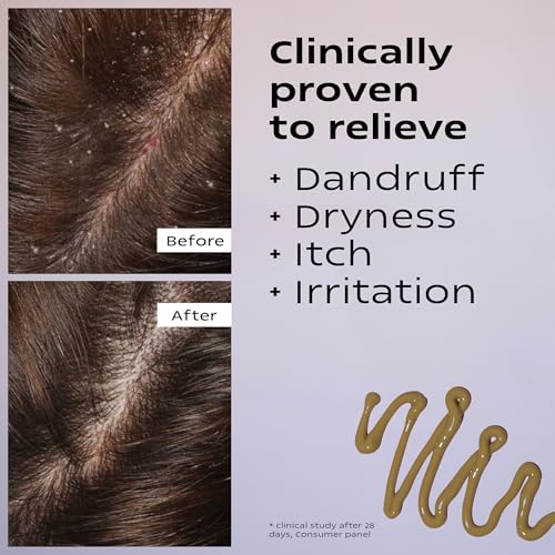 KAMEDIS Scalp Moisturizer Lotion For Dry, Itchy, Dandruff, Flaky & Sensitive Scalp. Over-Night Mask Treatment Botanicals-Based. Parabens Free. 3.38 Fl Oz.