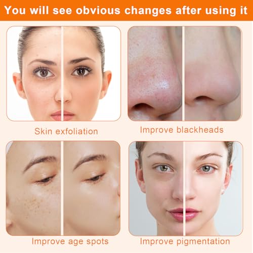 Diamond Microdermabrasion Machine,Mcwdoit 3 in 1 Dermabrasion Facial Machine for Exfoliation & Blackhead Removal,Home Spa Use Facial Skin Care Device