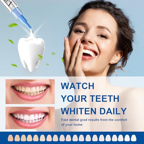 LUCKIN SMILE 10-Pack 35% Teeth Whitening Gel Refills, 35% Carbamide Peroxide Gel, 60 Whitening Treatments, No Sensitivity Teeth Whiteners, 3ml Whitening Gel for Teeth Whitening Kits