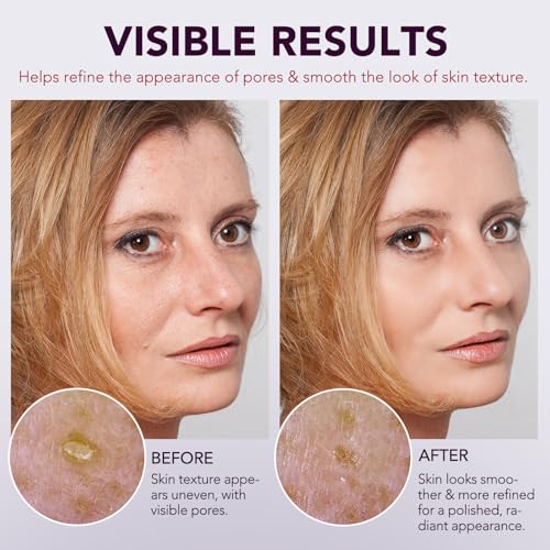 Peel Shot Glow Rice Ampoule Duo | Black Rice Exfoliant Face and Pore Cleaner with Hyaluronic Acid & Rice Extract Serum | Facial Pore Exfoliator, Peelshot Blackhead Dead Skin Remover for Face (100ml)